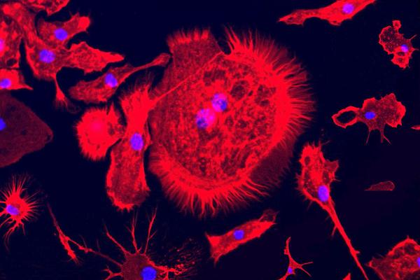 Buy My Cancer - Alivia | Ogilvy