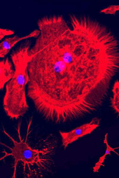 Buy My Cancer - Alivia | Ogilvy