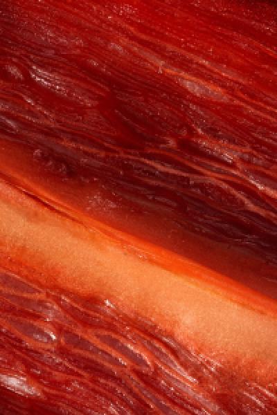 Meat - Burger King | Ogilvy